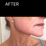 AFTER.png__PID:60218dde-73c9-4ff8-8af0-ec700dd927df