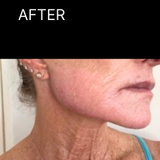 AFTER.png__PID:60218dde-73c9-4ff8-8af0-ec700dd927df