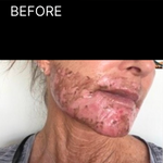 BEFOREpng.png__PID:218dde73-c91f-480a-b0ec-700dd927dfb7