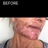 BEFOREpng.png__PID:218dde73-c91f-480a-b0ec-700dd927dfb7