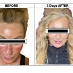 before after image.jpeg__PID:2417a7be-a694-4eb2-b7fe-46e87f8a0b9c