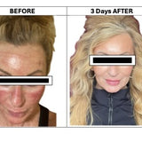 before after image.jpeg__PID:2417a7be-a694-4eb2-b7fe-46e87f8a0b9c