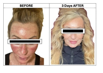 before after image.jpeg__PID:2417a7be-a694-4eb2-b7fe-46e87f8a0b9c